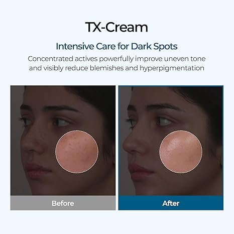 Dr Melaxin Tranexamic Cream | Skin freckle Cream, Anti-pigmentation For All Skin