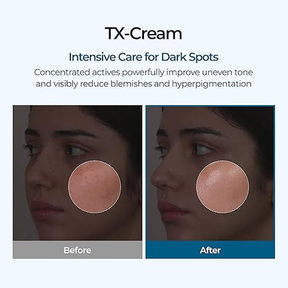 Dr Melaxin Tranexamic Cream | Skin freckle Cream, Anti-pigmentation For All Skin