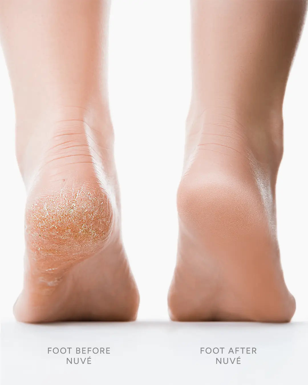 Electric Pedi Callus Remover